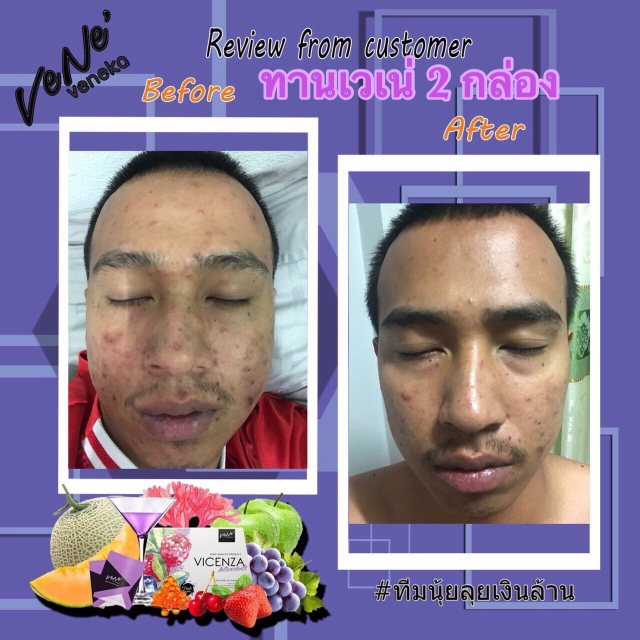 gallery/รีวิวลคทานเวเน่_180505_0046
