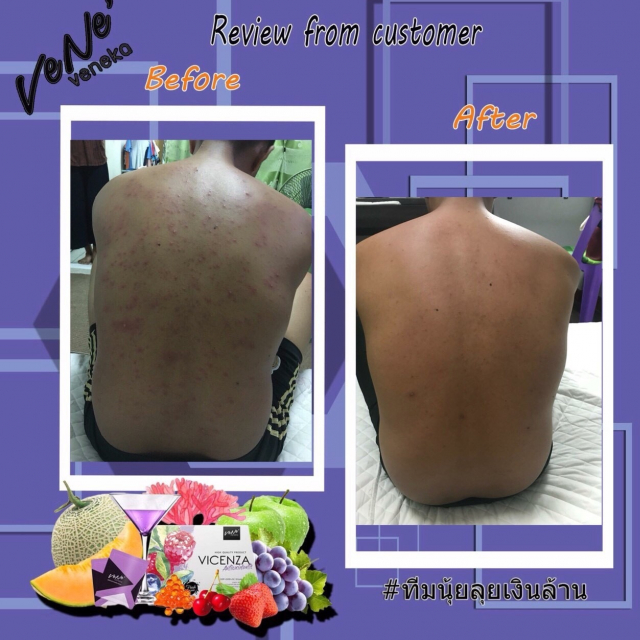 gallery/รีวิวลคทานเวเน่_180505_0045