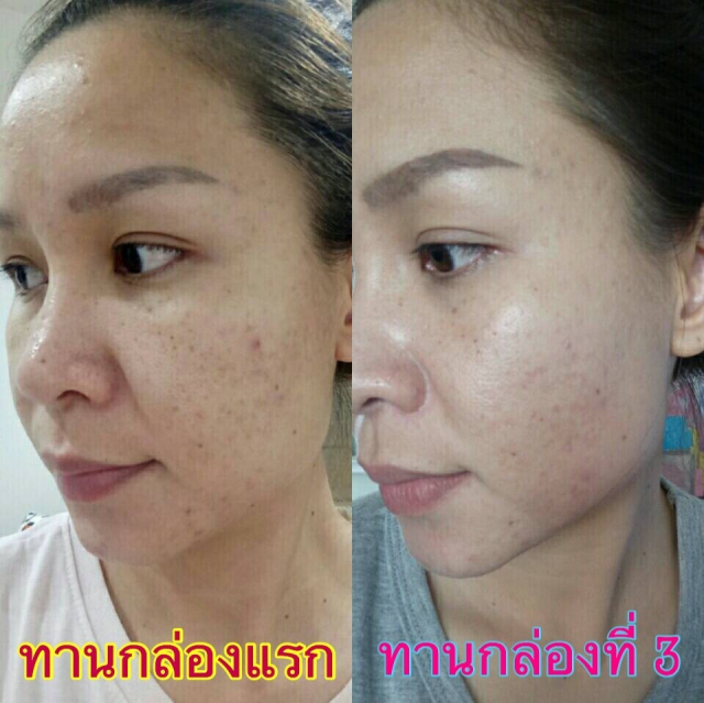 gallery/รีวิวลคทานเวเน่_180509_0034