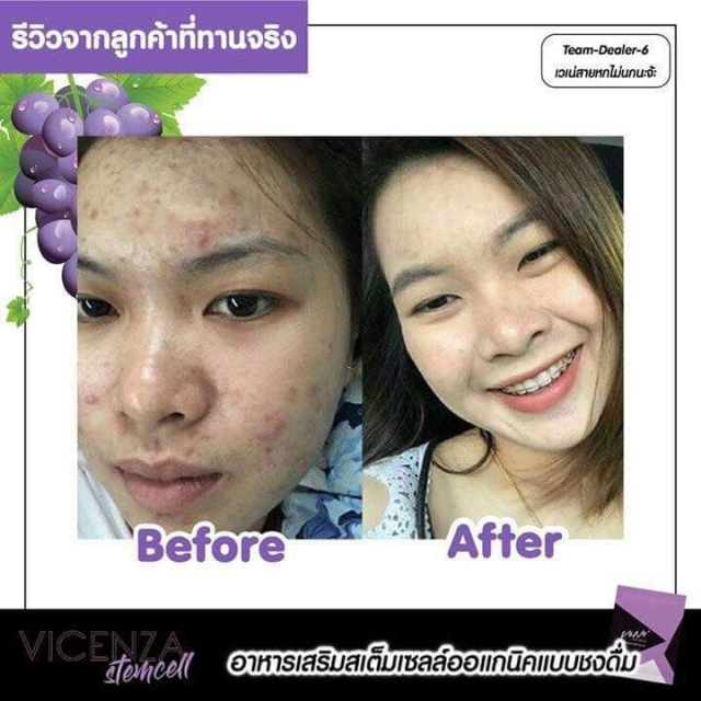 gallery/รีวิวลคทานเวเน่_180505_0018