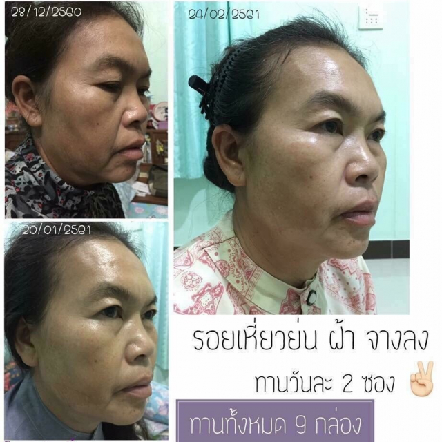 gallery/รีวิวลคทานเวเน่_180505_0044