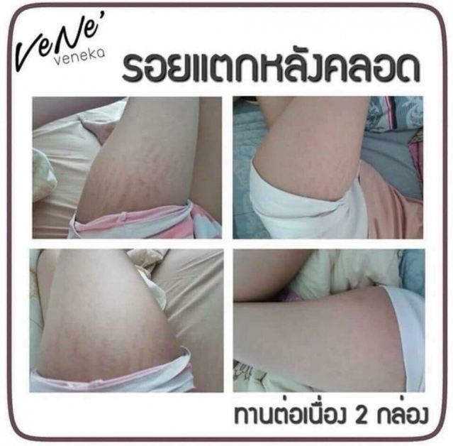 gallery/รีวิวลคทานเวเน่_180509_0036